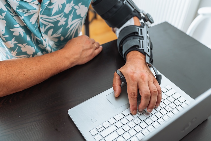 A software developer Repetitive Strain Injuries